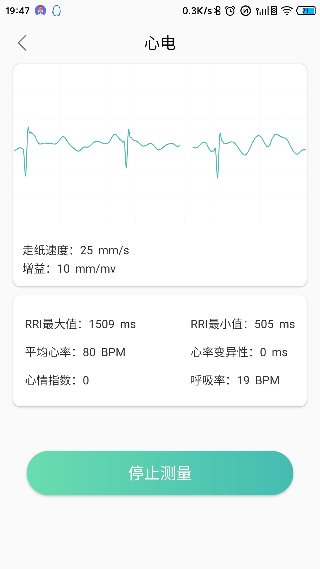 MinttiVision智能健康监护仪图0